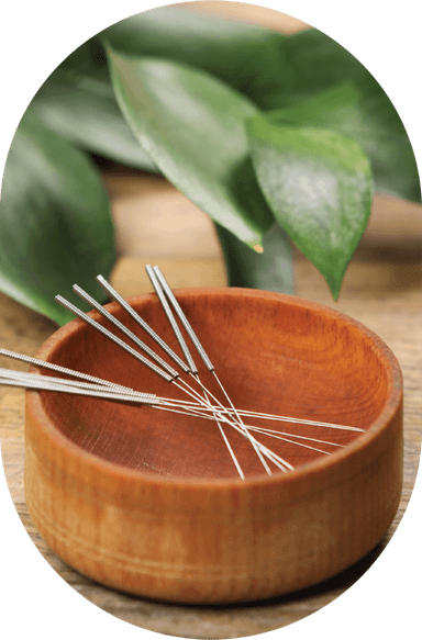 Acupuncture treatment at Essencia Wellness, Sydney's Northern Beaches